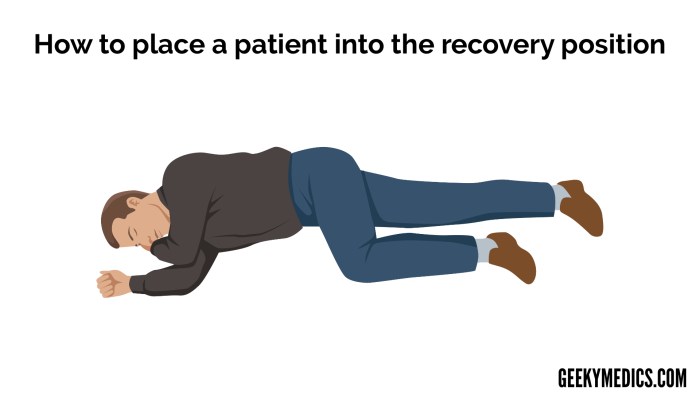 Mengenal Recovery Position (Posisi Mantap) dalam K3